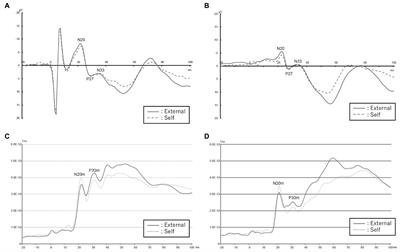 Approach to impaired corollary discharge in patients with schizophrenia: An analysis of self-induced somatosensory evoked potentials and fields